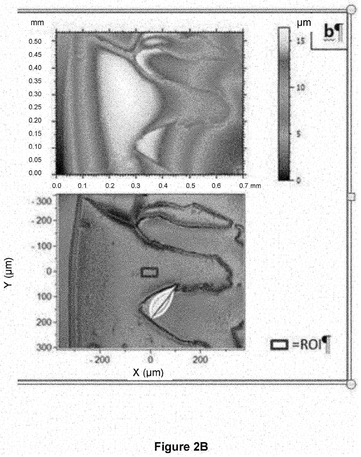 Method for detecting joint diseases