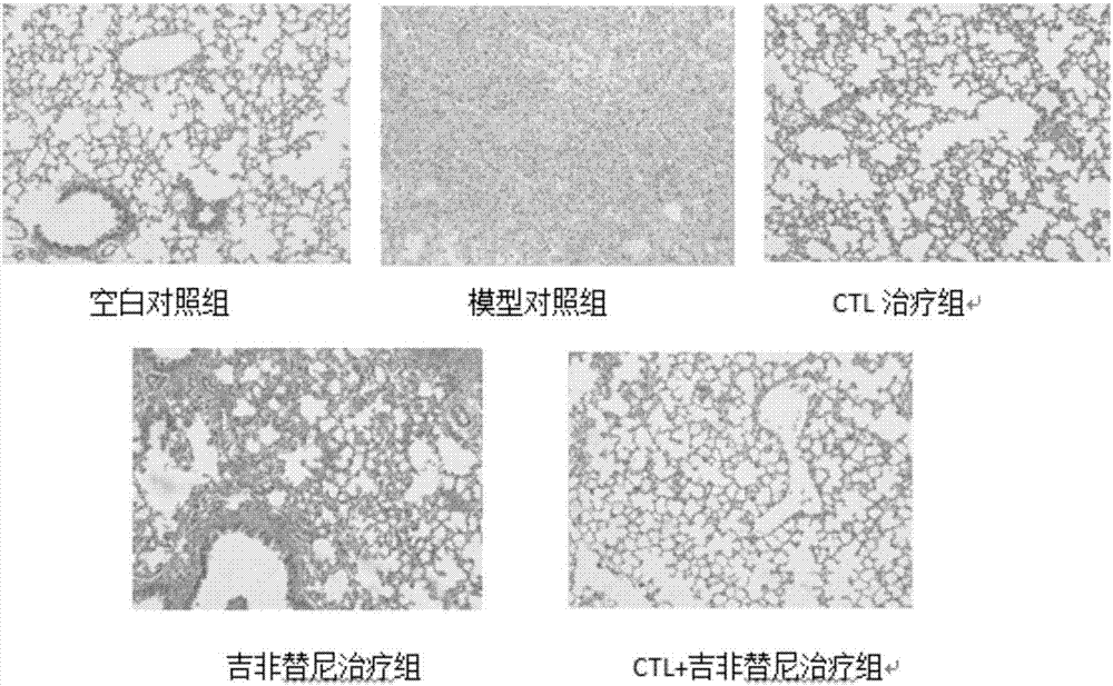 Antigen peptide T790M-4 and application to preparation of medicines for treating non-small cell lung cancer thereof