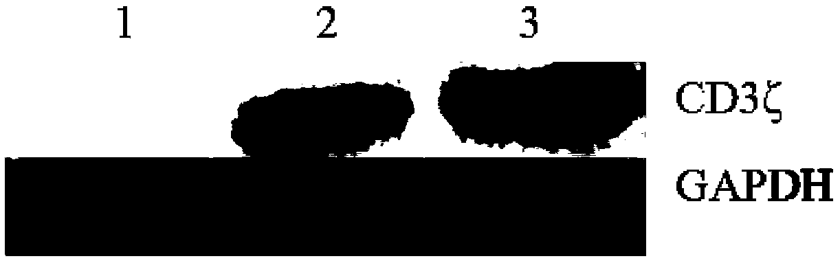 Preparation method and application of third-generation LMP1 (latent membrane protein 1) CAR-T (Chimeric Antigen Receptor T) cells