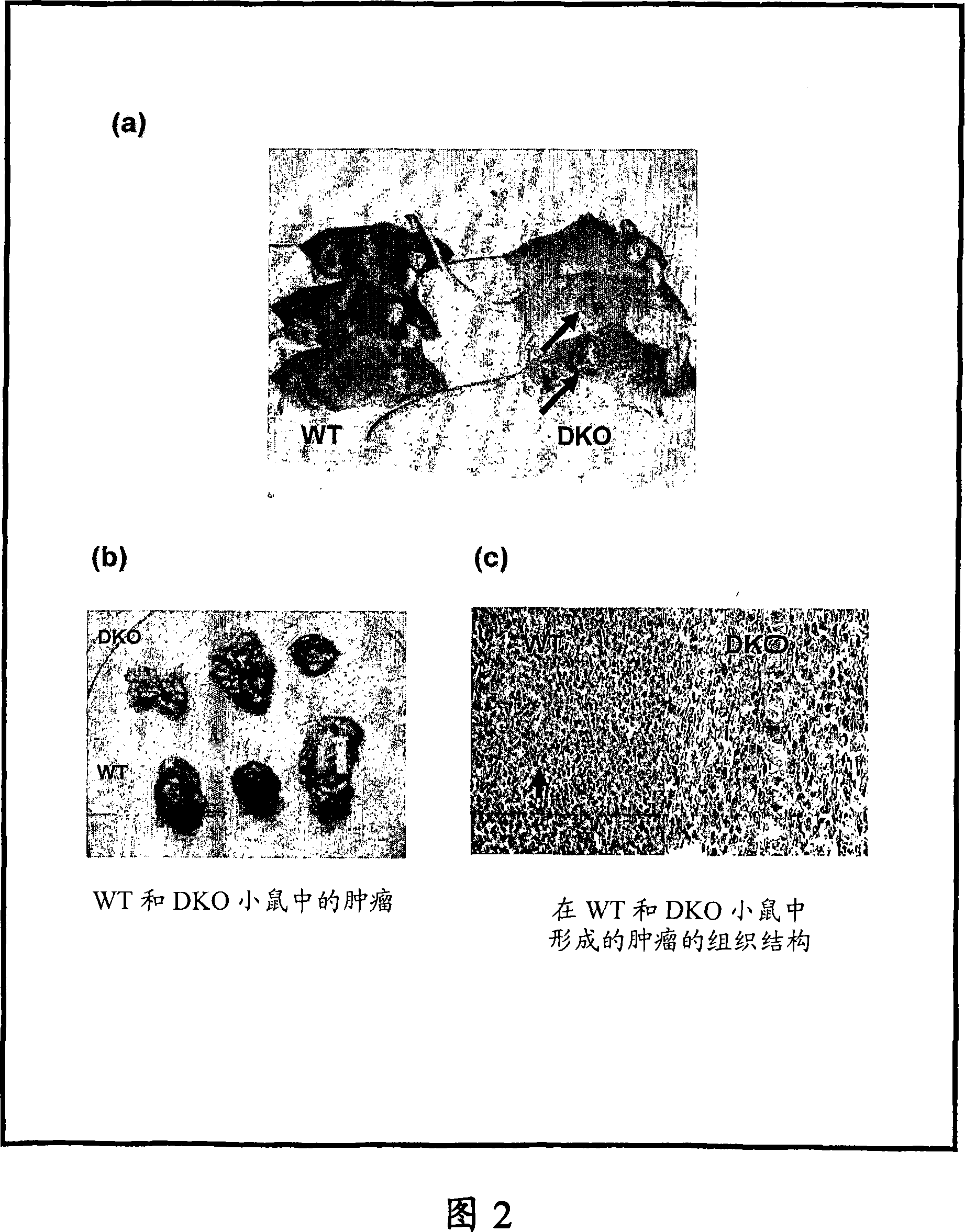 Duffy antigen receptor for chemokines and use thereof