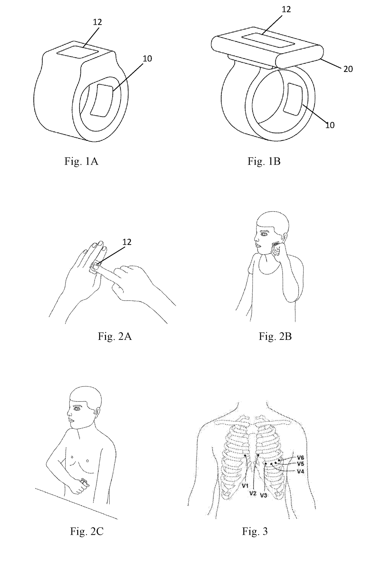 Wearable electrocardiographic measurement device