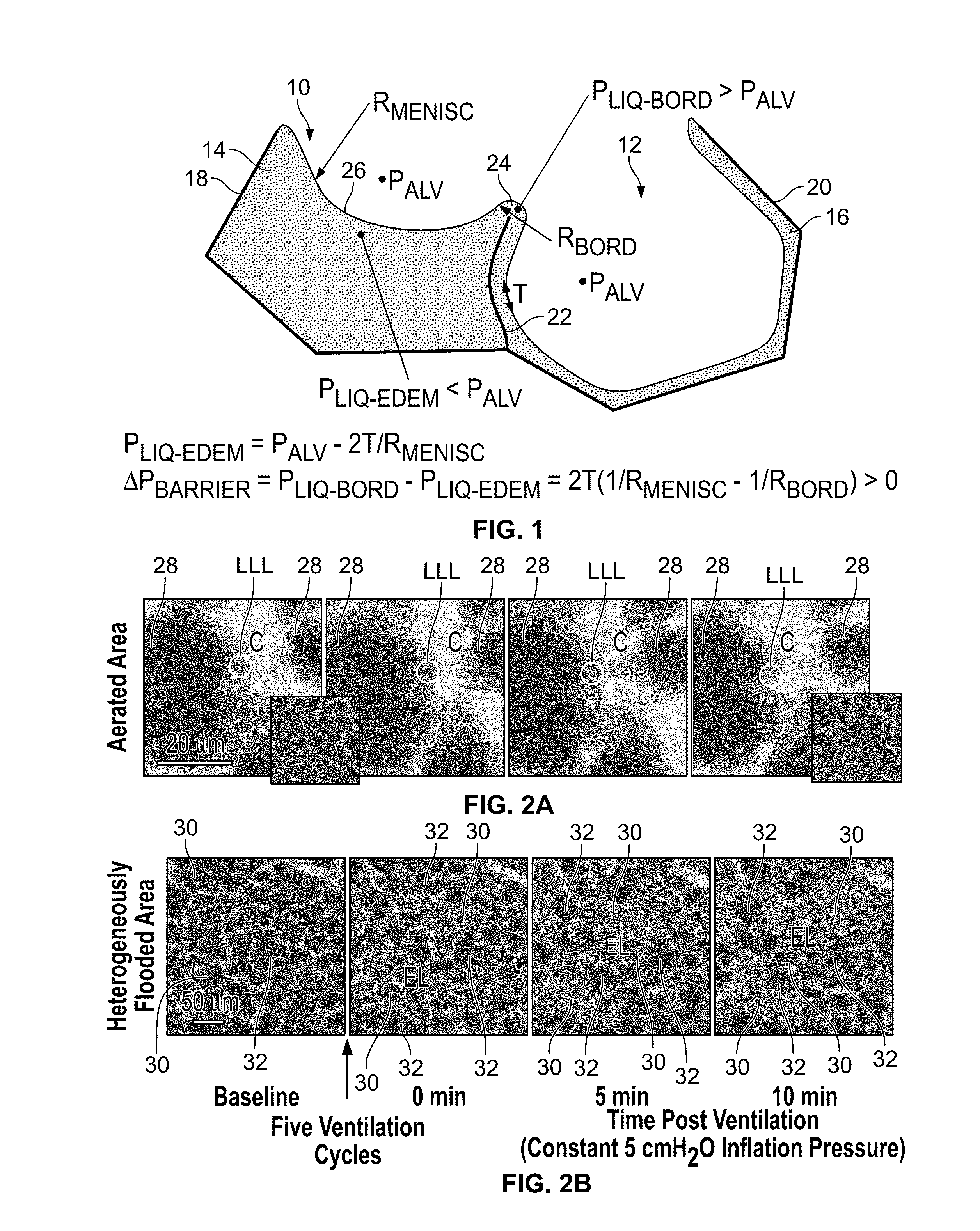 Use of rhodamine dyes to reduce alveolar surface tension