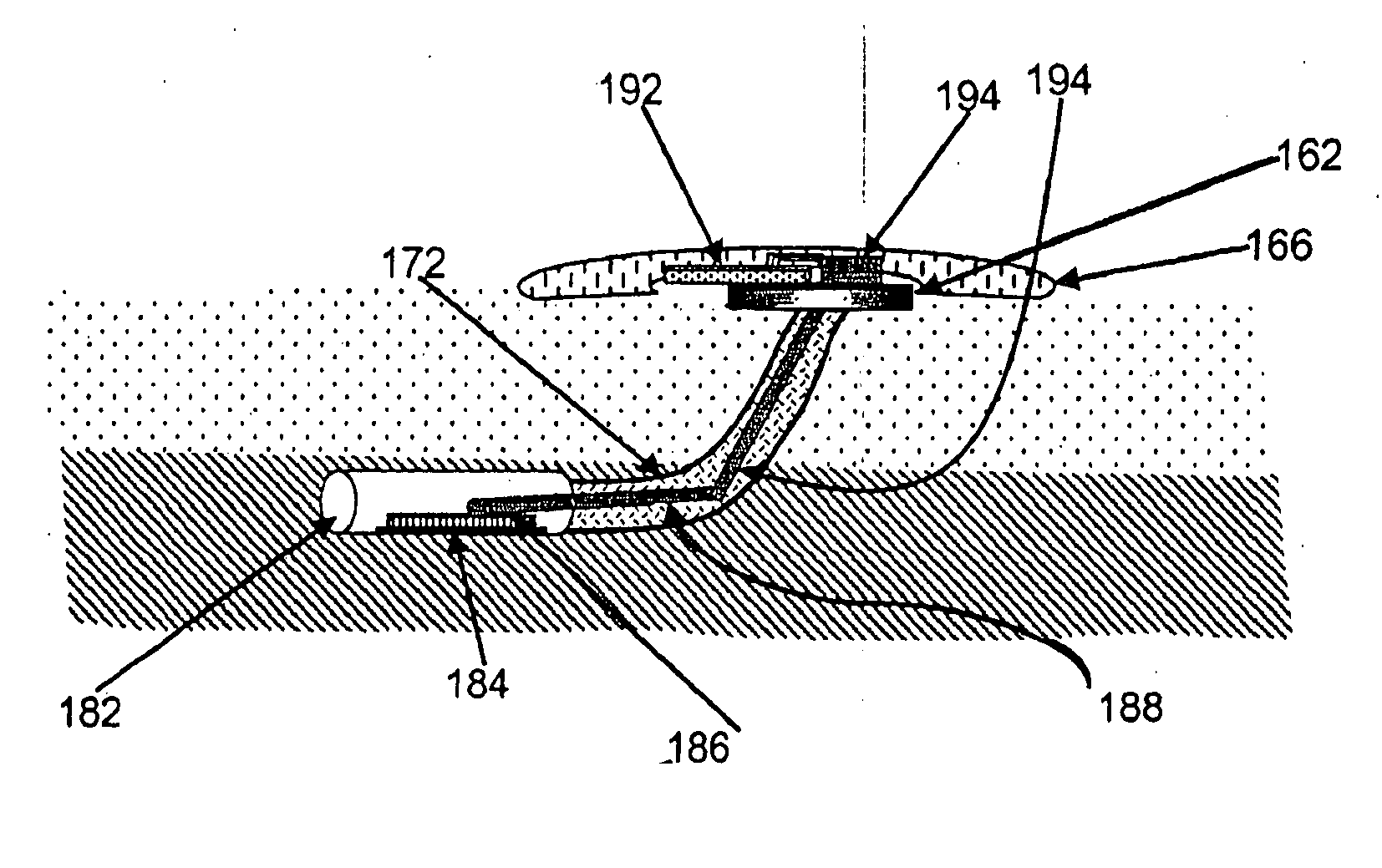 Gateway platform for biological monitoring and delivery of therapeutic compounds