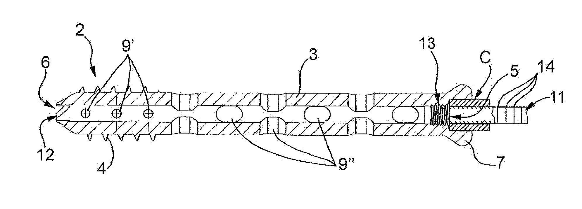 Device for selective biological synthesis of a bone tissue