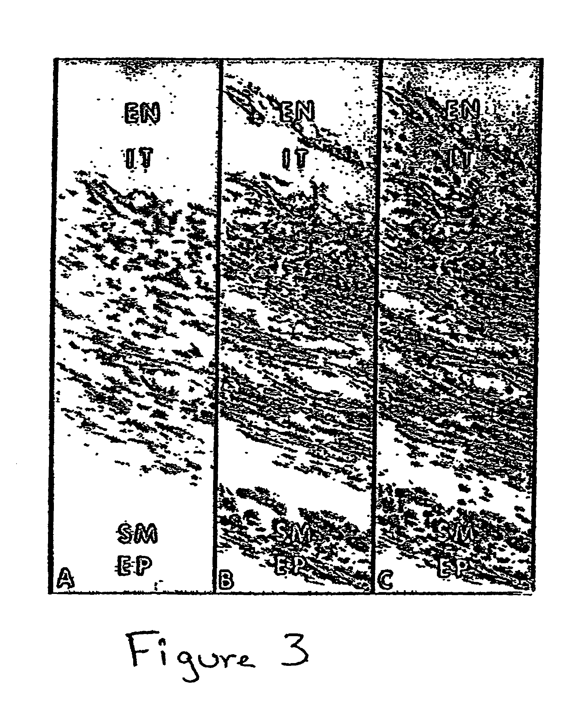 Methods and compositions for the repair and/or regeneration of damaged myocardium