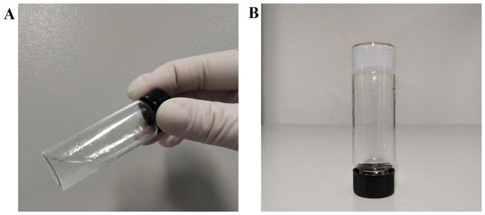 Preparation method of decellularized amnion intrauterine scaffold carrying estradiol microspheres