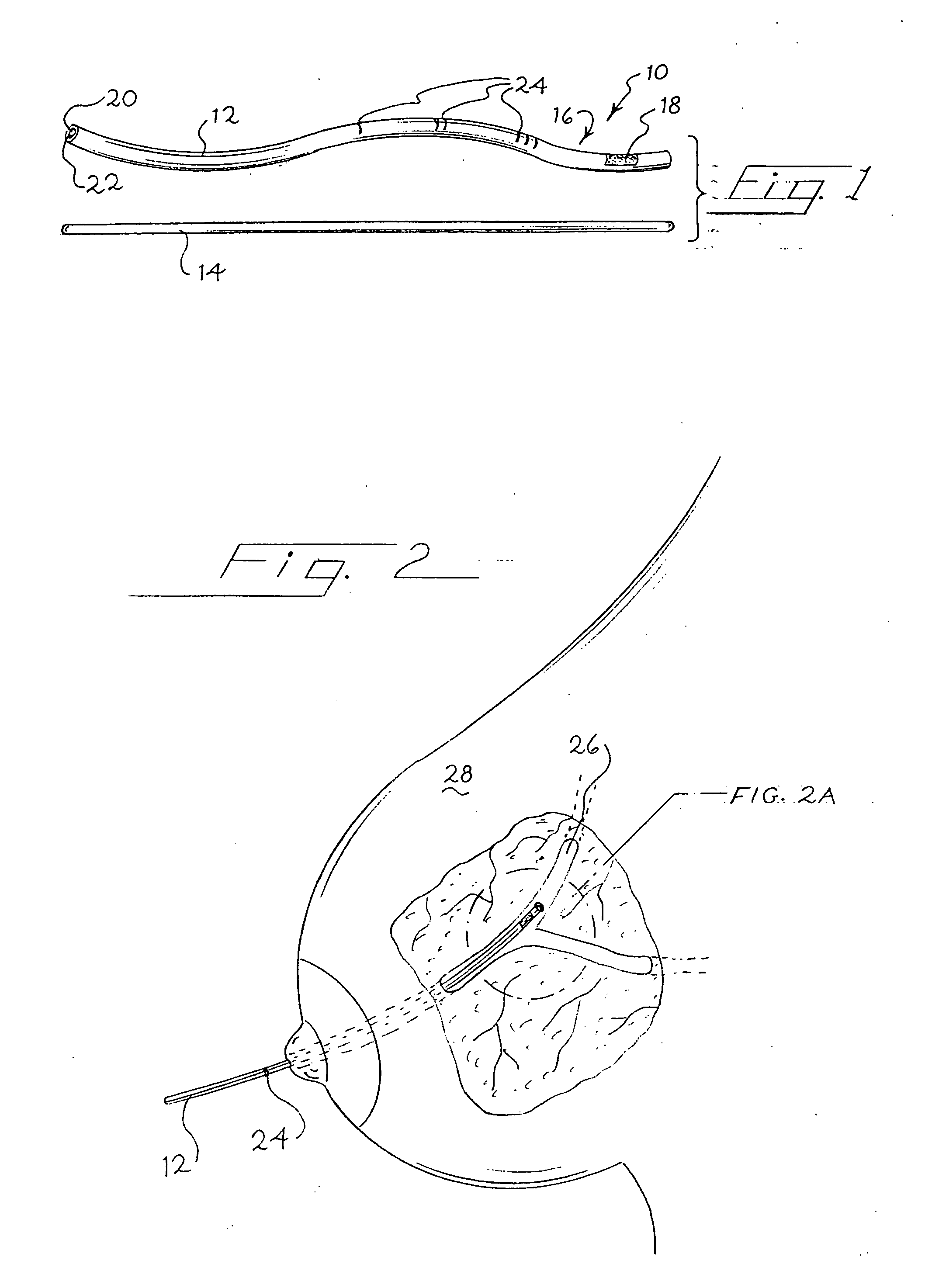 Marker and cut down guide assembly for human mammary duct procedures and method