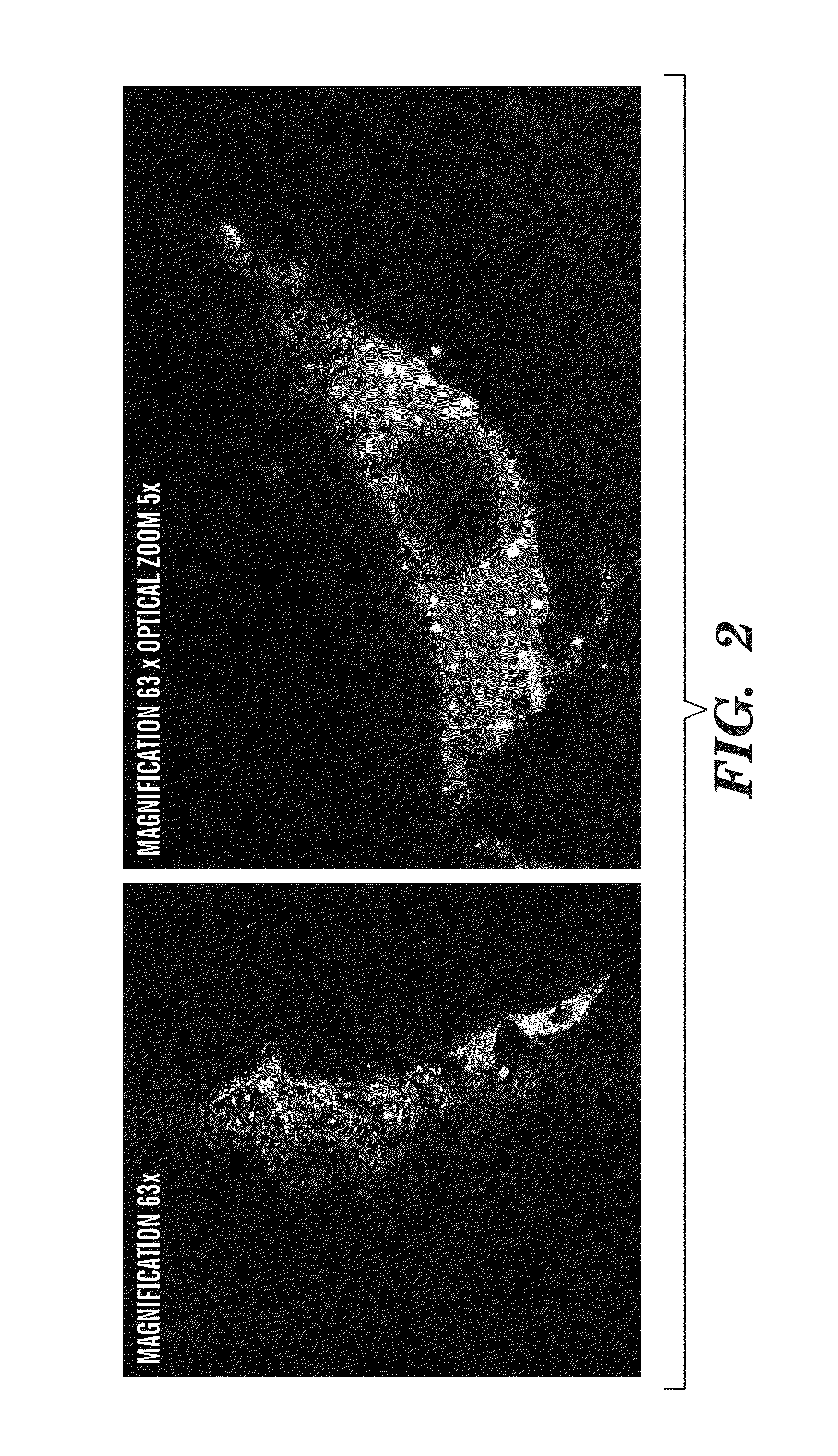 Nano-targeted delivery of protease, polymerase inhibitors with or without immune modulators in the treatment of hepatitis c