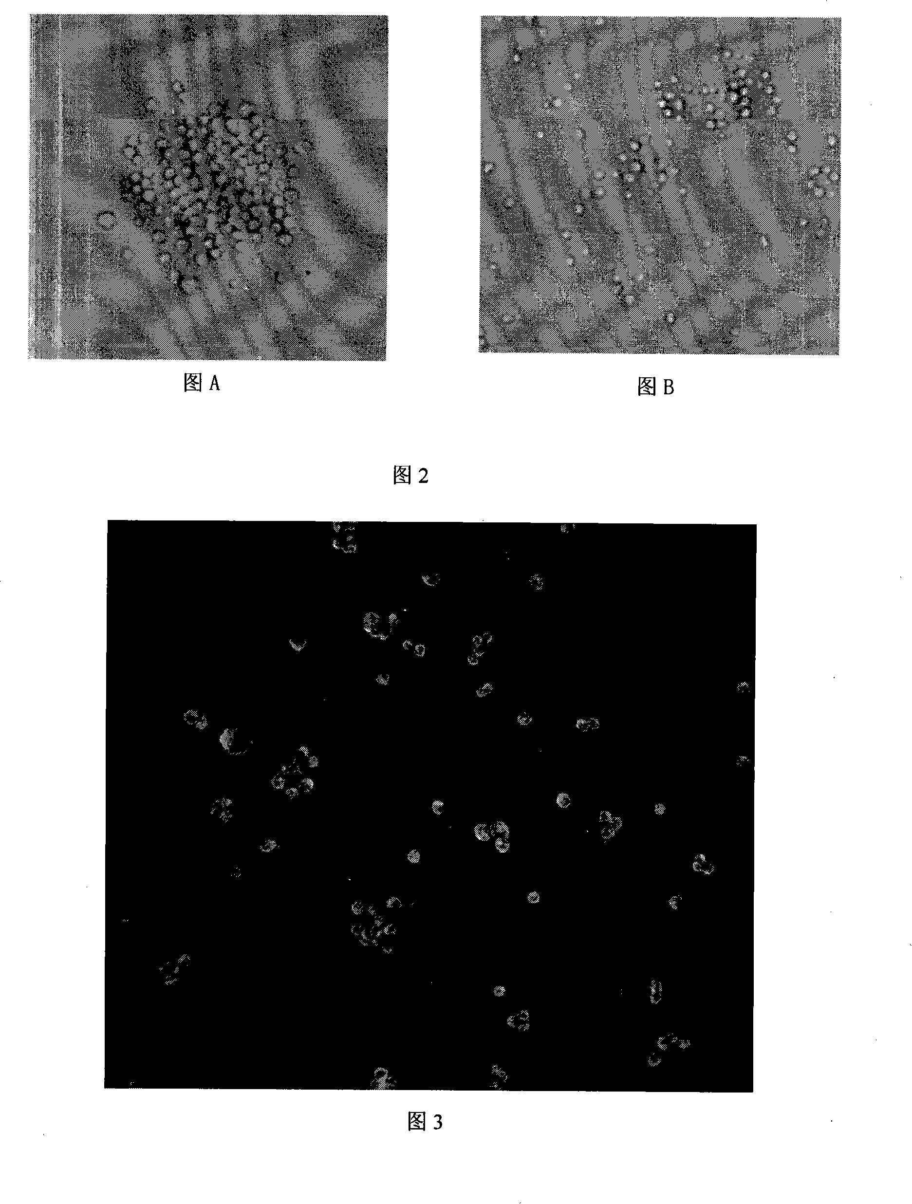 Non-blood serum low density culture medium for animal cell and use thereof