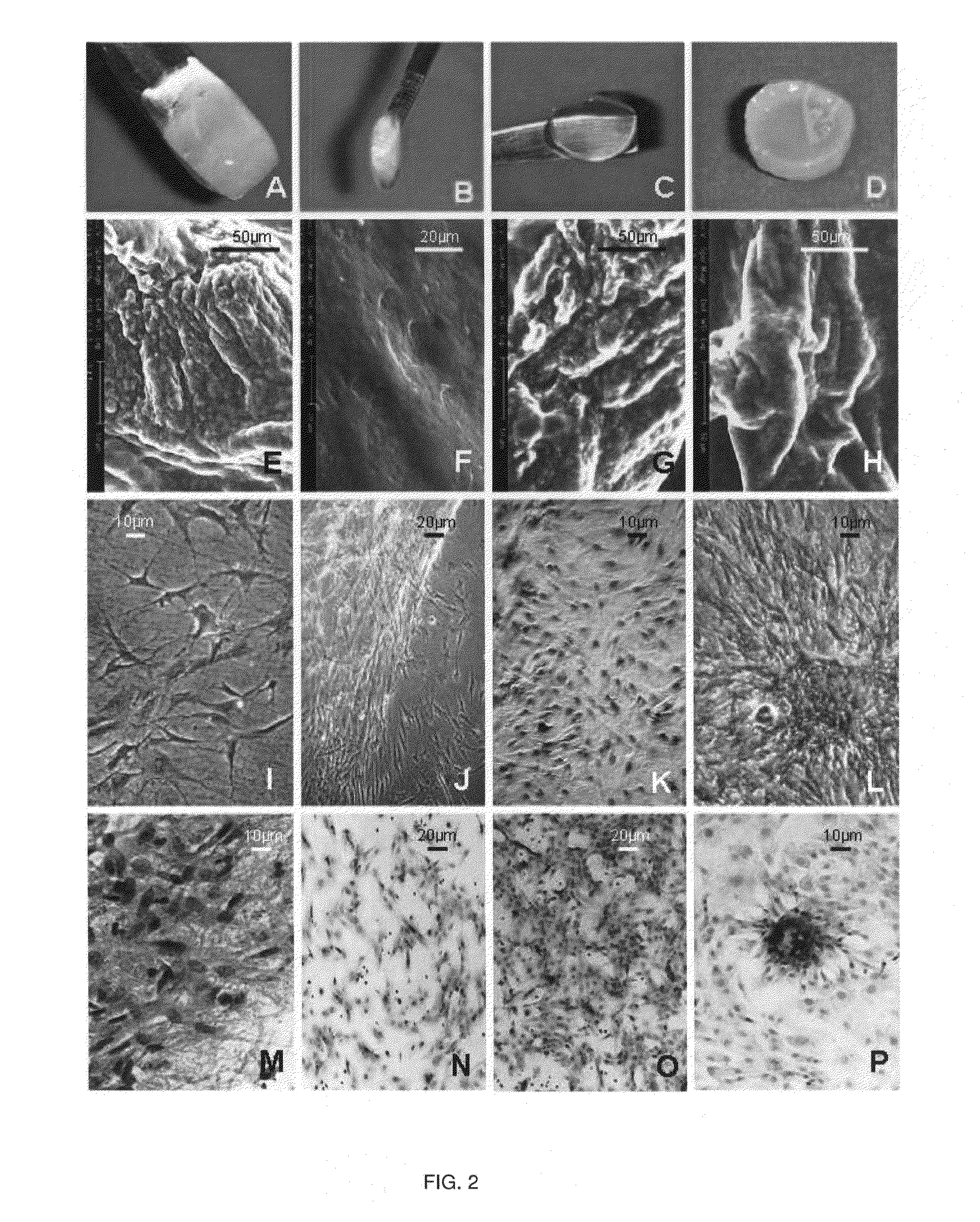 Graft composition for neural tissue regeneration, method of production and uses thereof