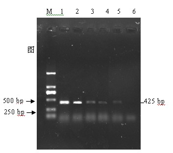 Primer group and kit for multiple PCR detection of rabbit Pasteurella multocida and rabbit Bordetella bronchiseptica and detection method thereof