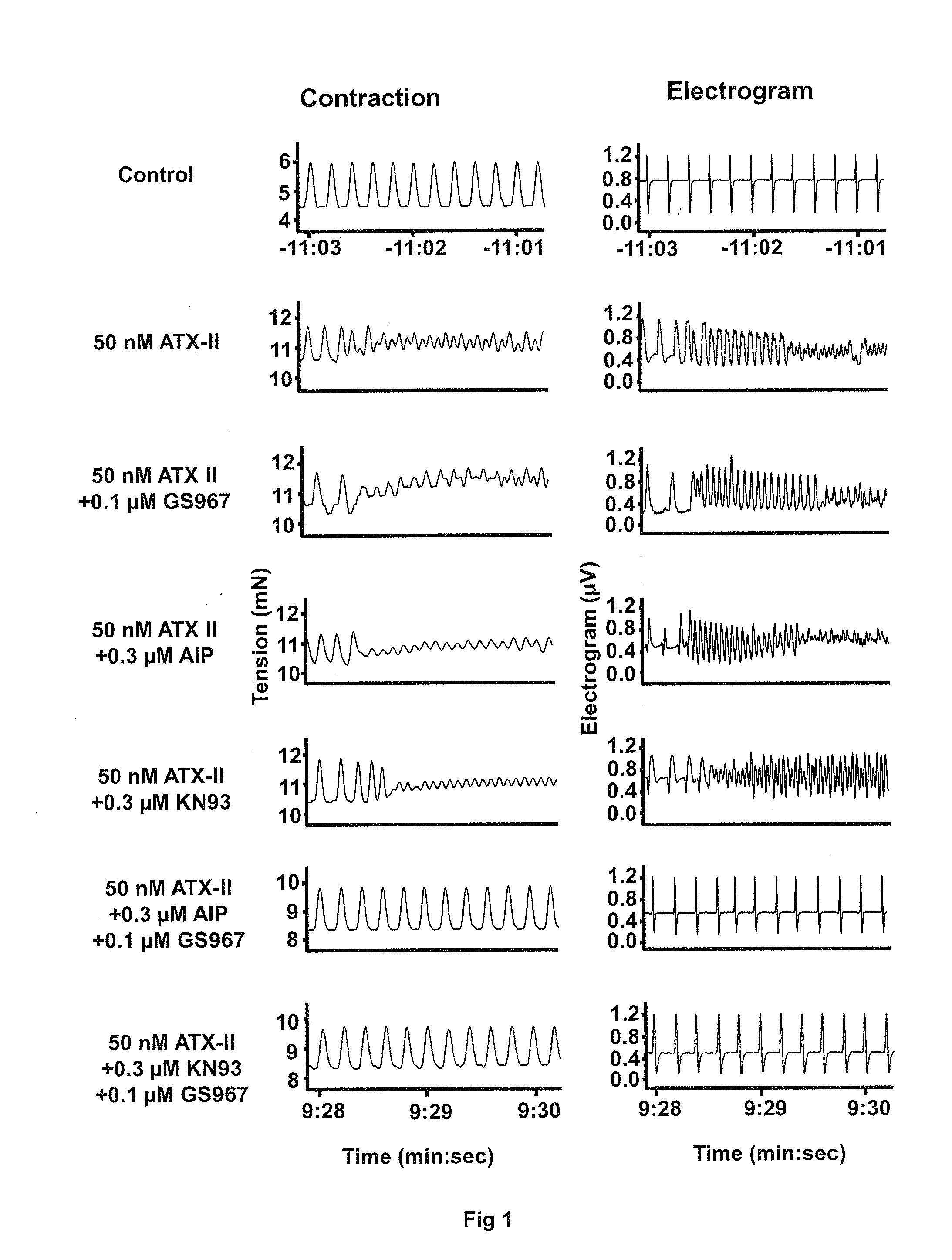 Combination therapy for the treatment of arrhythmias or heart failure