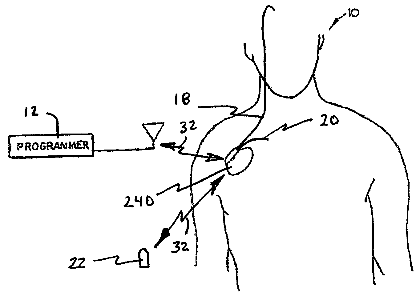 System and method for regulating cardiopulmanary triggered therapy to the brain