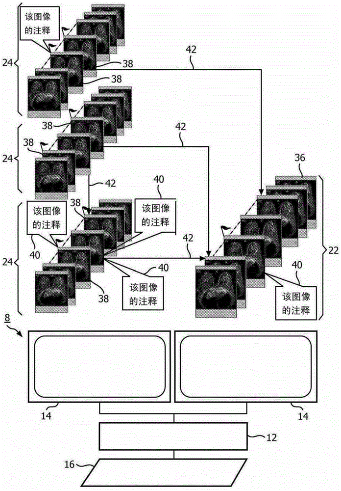 Medical image navigation