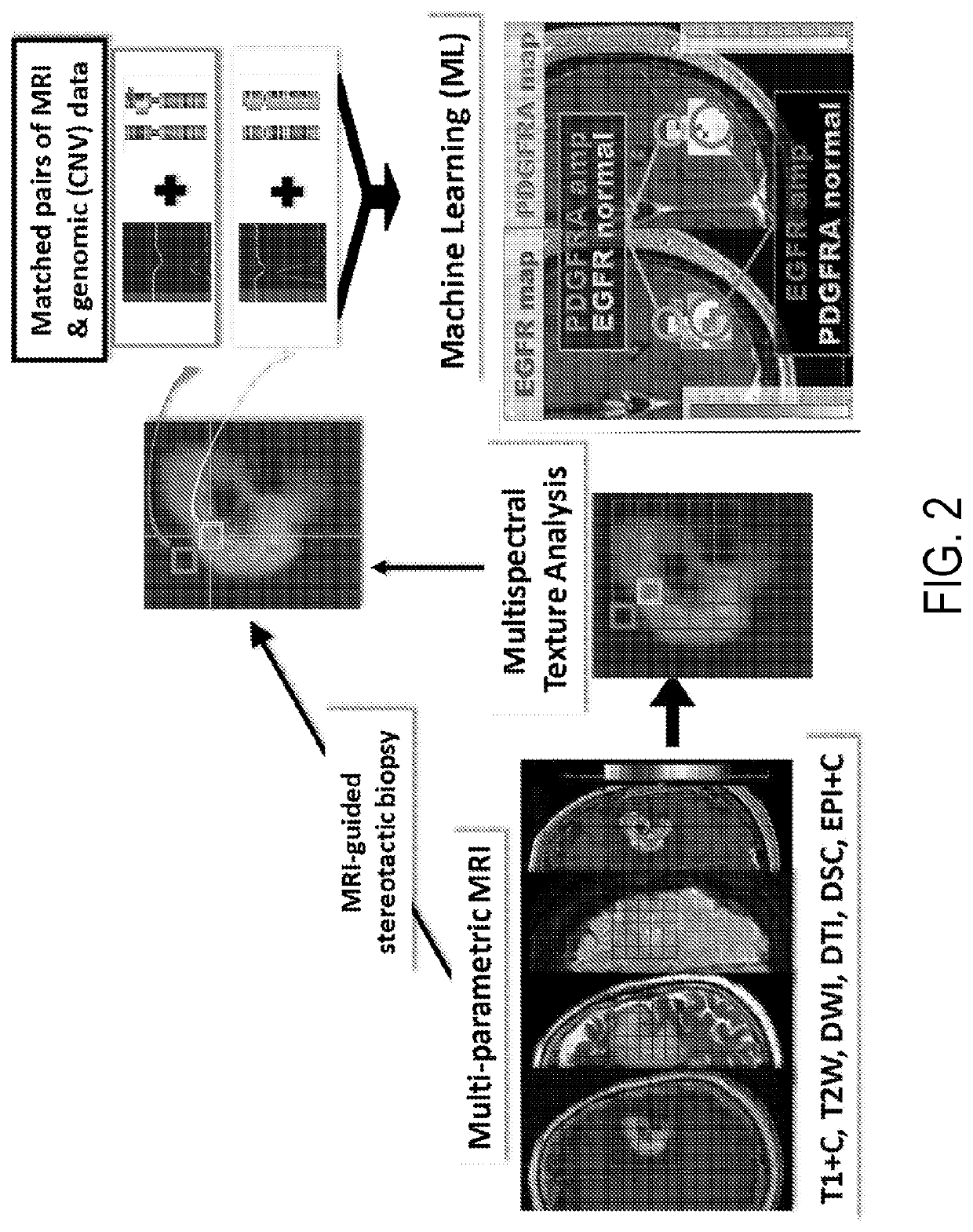 Systems and Methods for Quantifying Multiscale Competitive Landscapes of Clonal Diversity in Glioblastoma