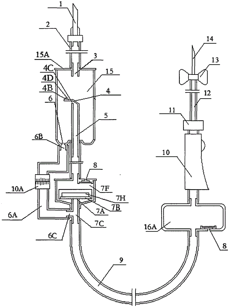 Anticoagulation liquid-stopping transfusion device with liquid-stopping sealant floating plug balloon catheter