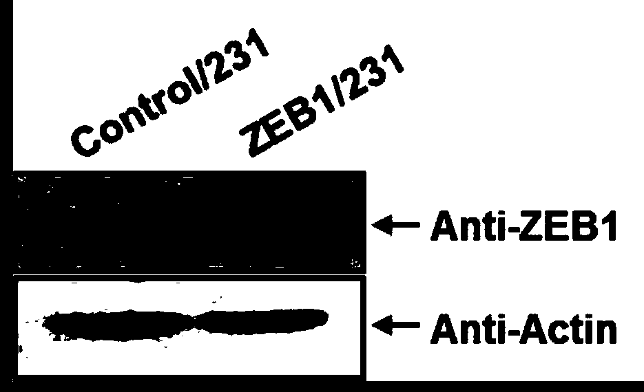 Application of transcription factor zeb1 in the preparation of drugs that promote breast cancer chemosensitivity