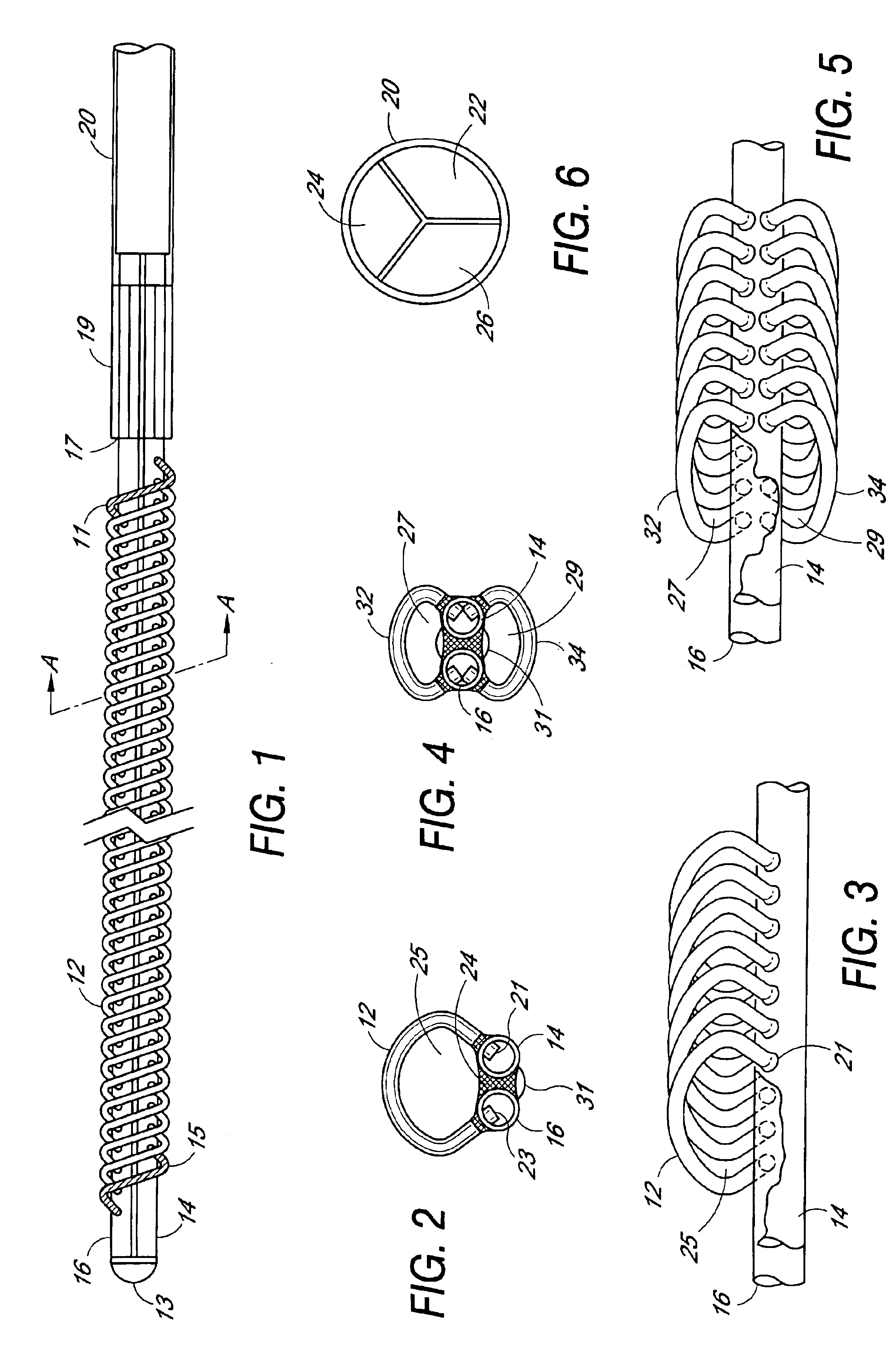 Plasmapheresis filter device and catheter assembly