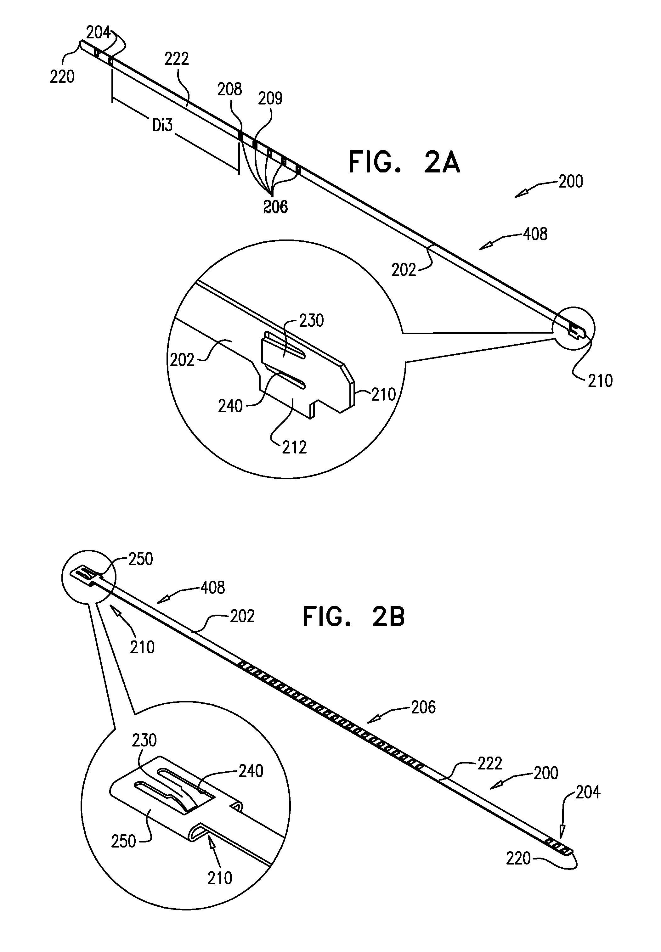 Implant and anchor placement