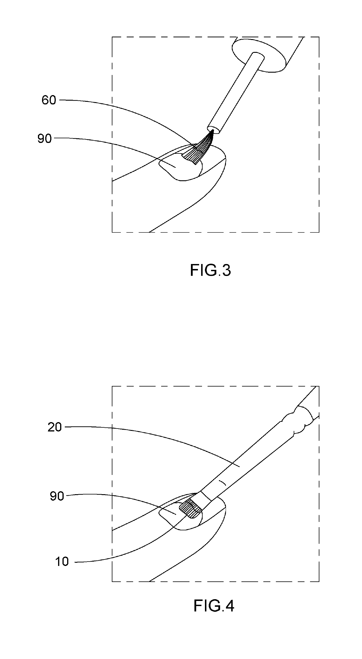 Artificial Nail Tip and Curing Composition Set and Applying Method Thereof