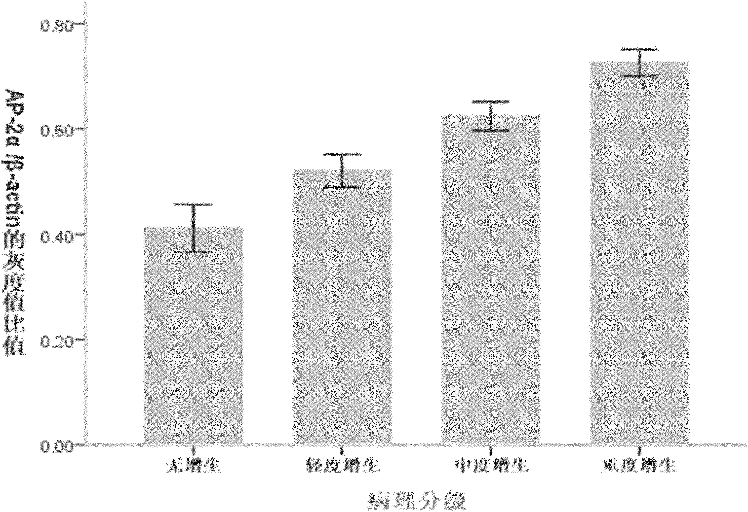 Cream preparation for preventing and curing mammary gland hyperplasia and preparation method thereof
