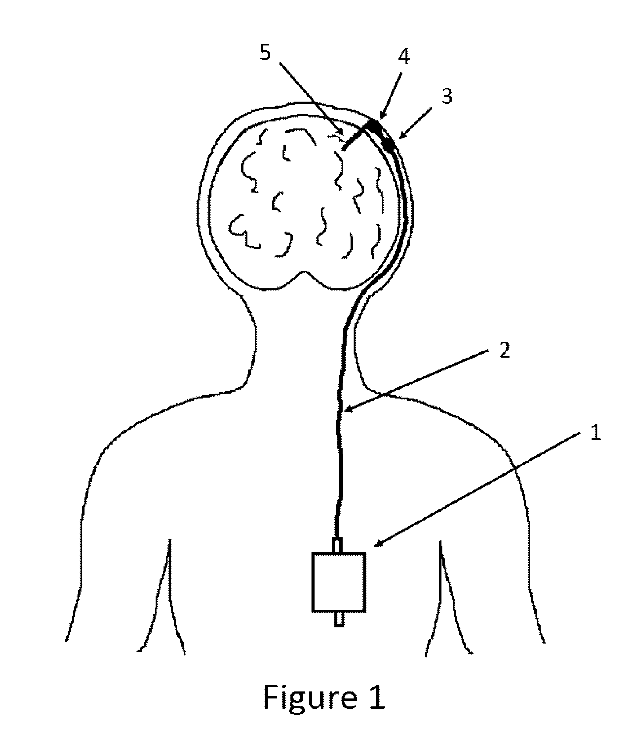 Multipurpose cerebrospinal fluid sensor assembly and method of operation of the same