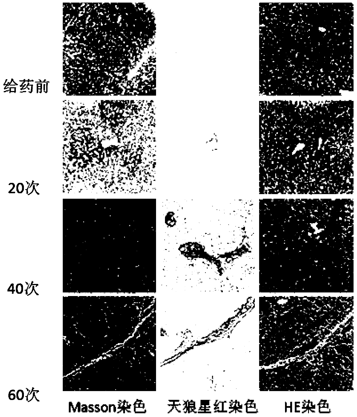 A method for establishing a rhesus monkey liver fibrosis model by intraperitoneal injection