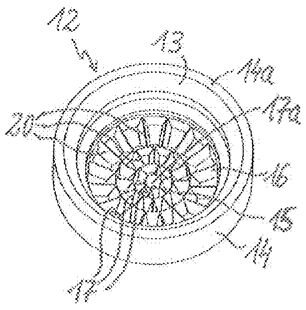 Fluid distributor body and sanitary shower device