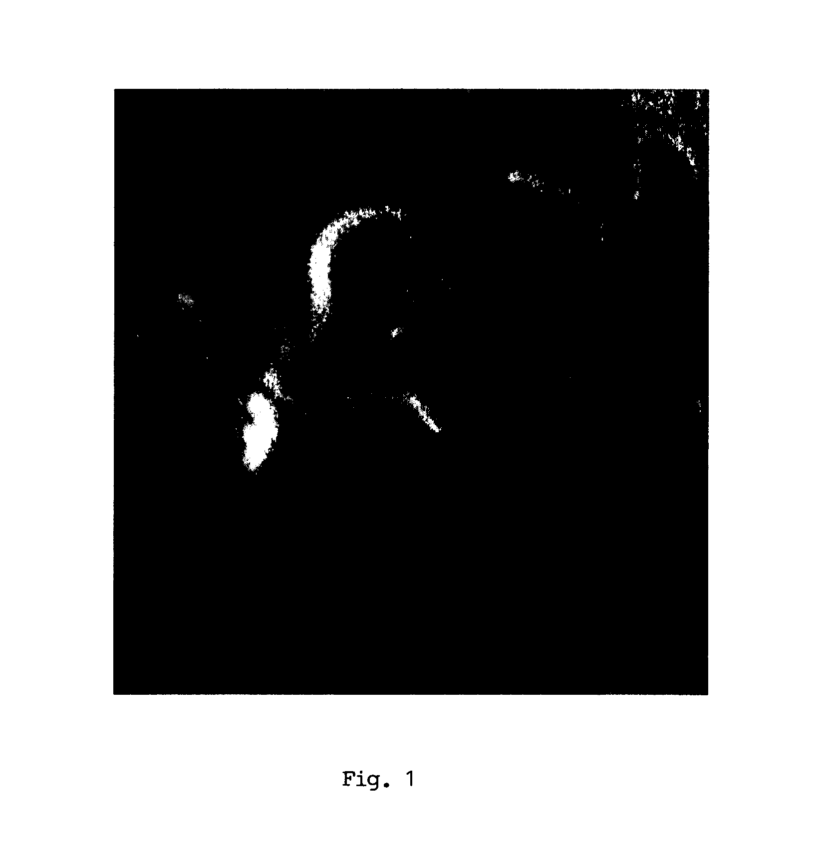 Method for enhancing blood vessels in angiography images