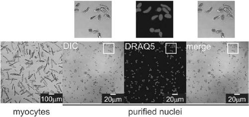 Cell nucleus extraction method