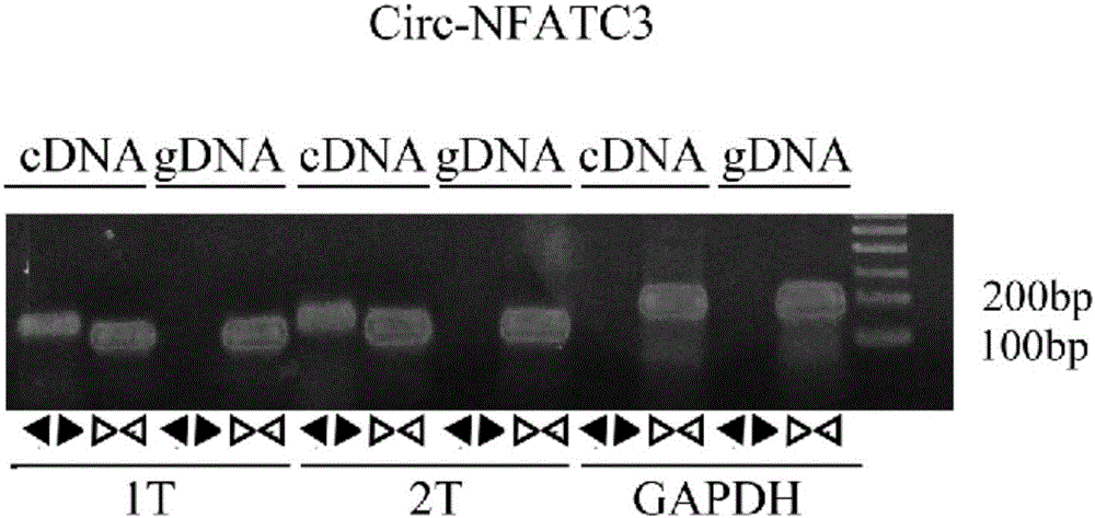 Ring-shaped RNA circ-NFATC3 and application thereof