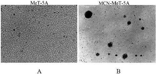Multiwalled carbon nanotube induced human pleural mesothelial cell malignant transformation strain and application thereof