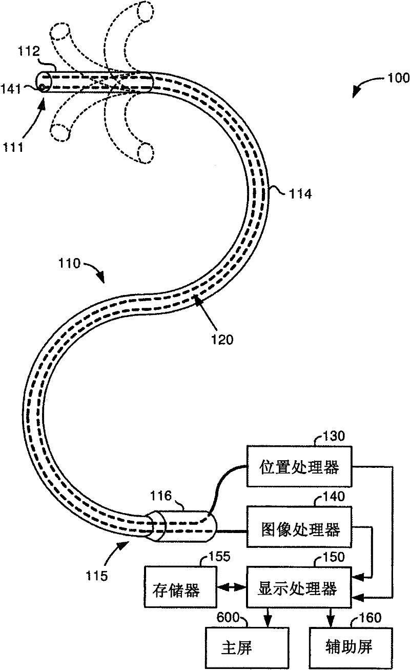 System for providing visual guidance for steering a tip of an endoscopic device towards one or more landmarks and assisting an operator in endoscopic navigation