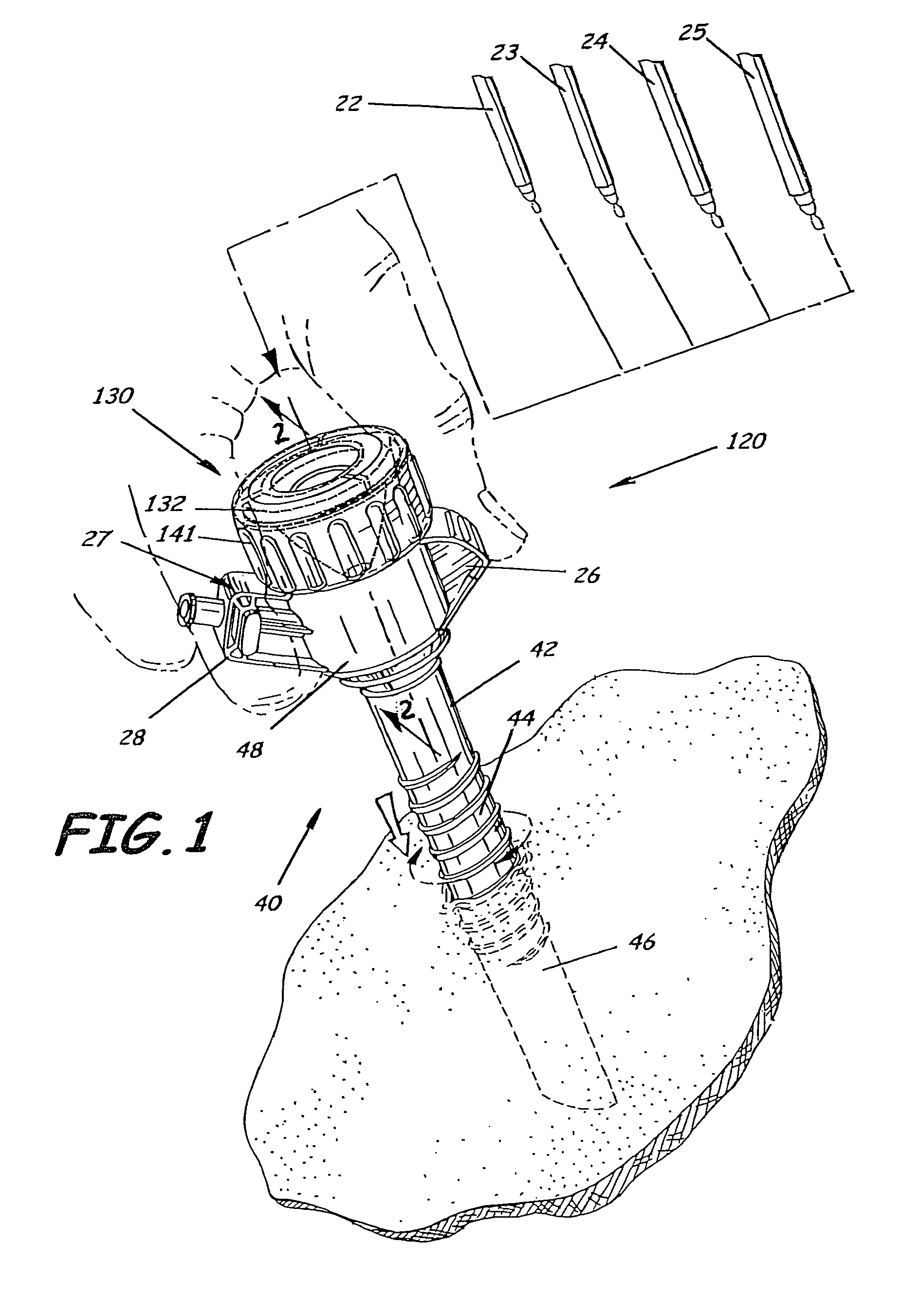 Trocar and cannula assembly having variable opening sealing gland and related methods