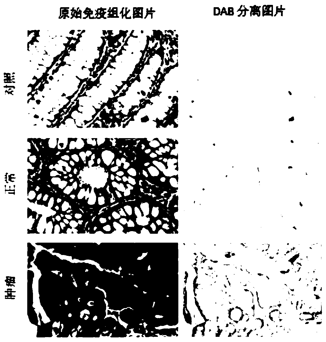 GLUT12 protein inhibitor and preparation method and application thereof