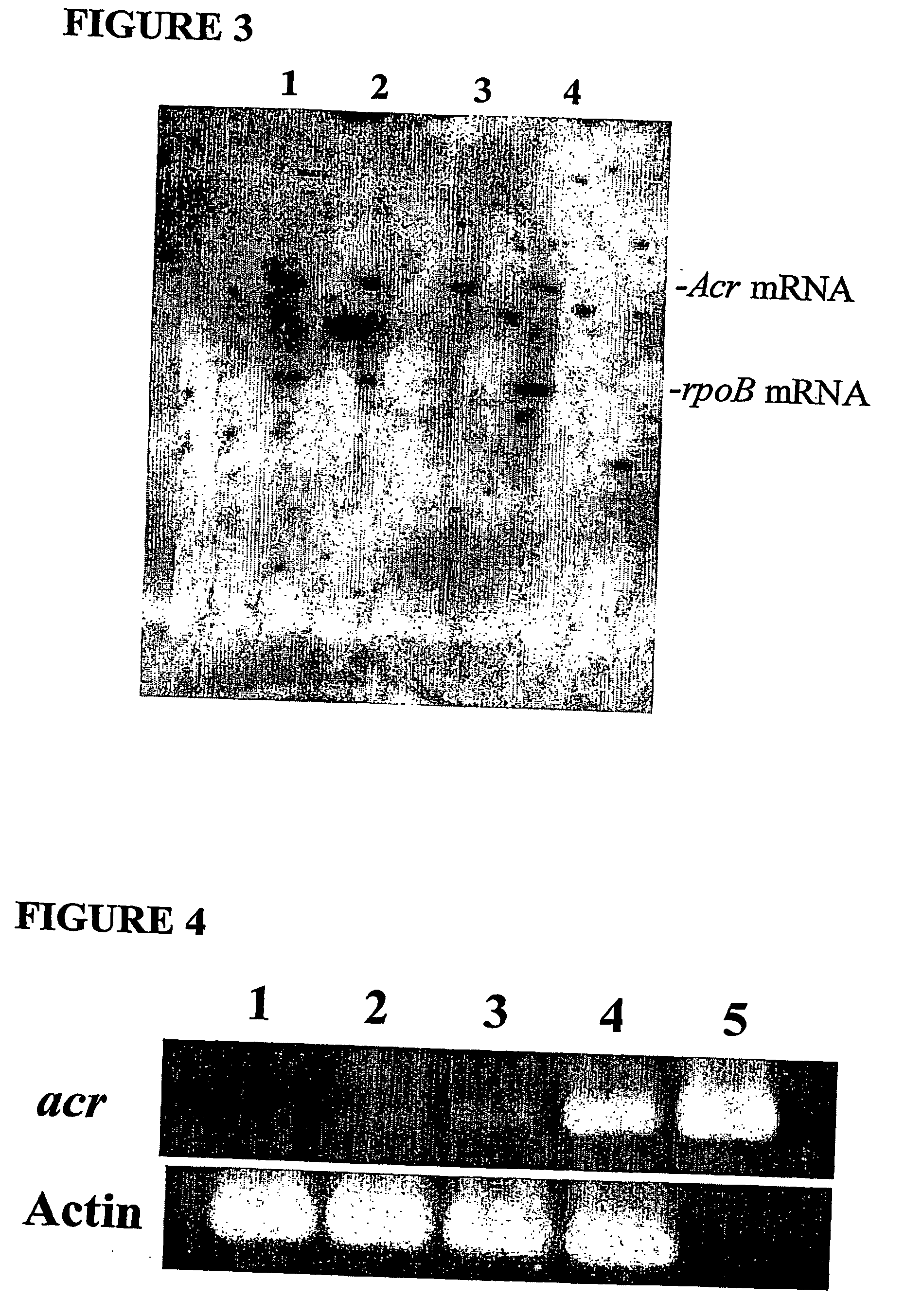 Latent human tuberculosis model, diagnostic antigens, and methods of use