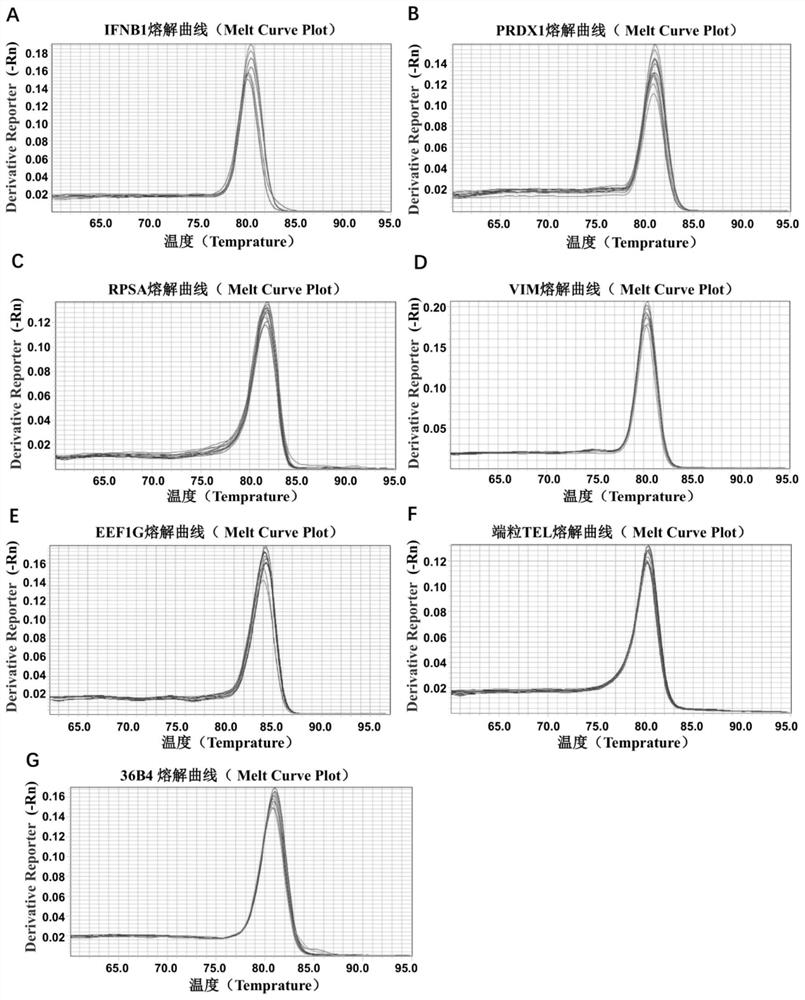 Telomere length detection primer composition and kit and application thereof