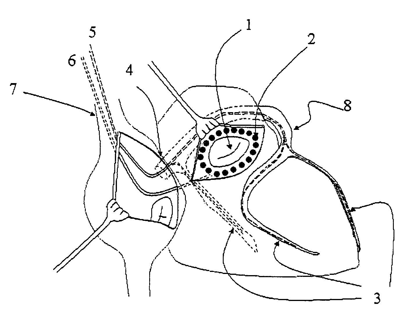 Methods and devices for modulation of heart valve function