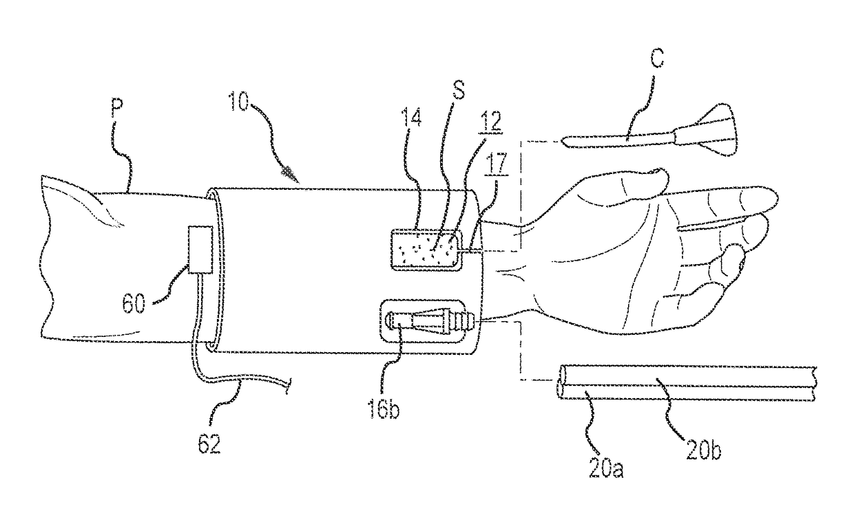 Pad, method and system for providing thermotherapy at intravascular catheter administration site