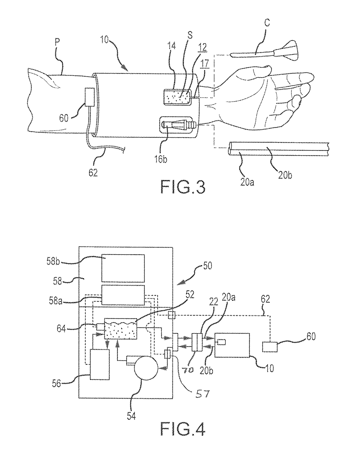 Pad, method and system for providing thermotherapy at intravascular catheter administration site