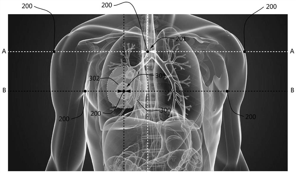 Method for determining CT positioning center