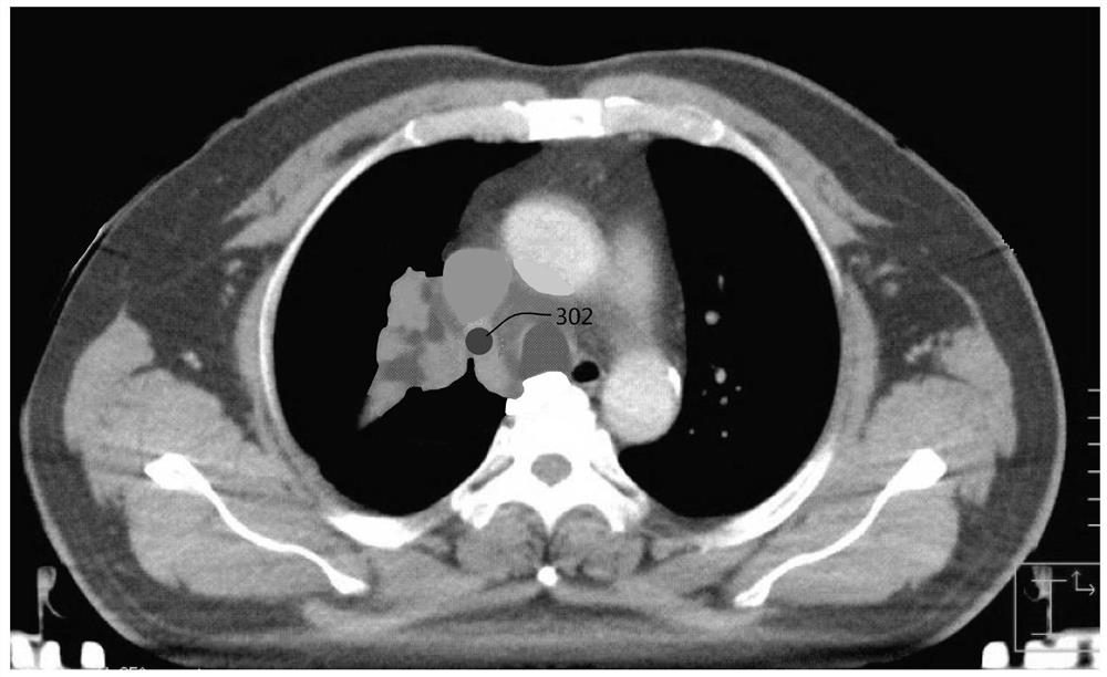 Method for determining CT positioning center