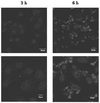 Preparation method and drug carrying method of escherichia coli outer membrane vesicle, and application of outer membrane vesicle in anti-tumor
