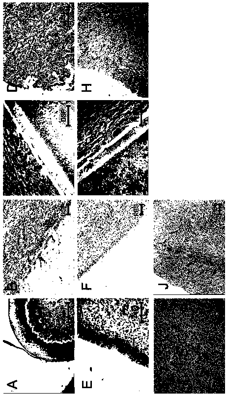 Dentin-pulp complex preparation method