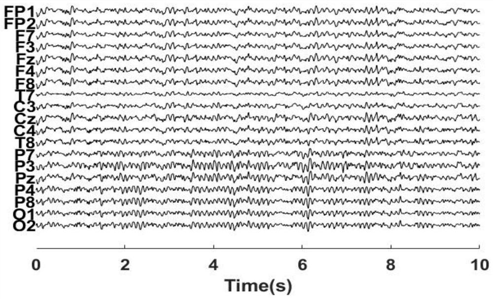 A method for eliminating myoelectric artifacts in state-related dynamic EEG signals