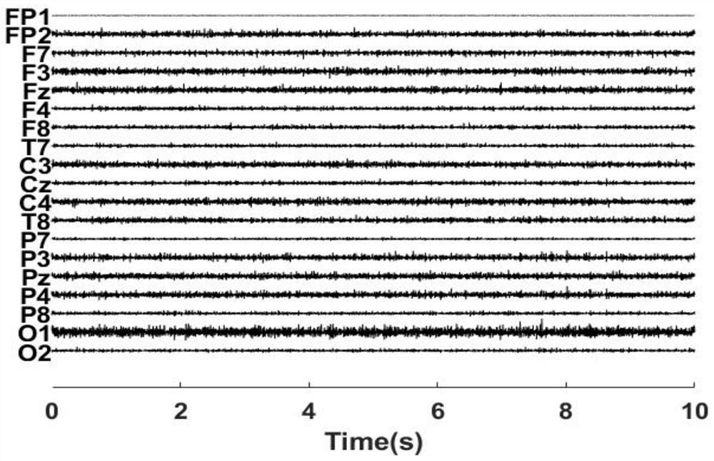 A method for eliminating myoelectric artifacts in state-related dynamic EEG signals