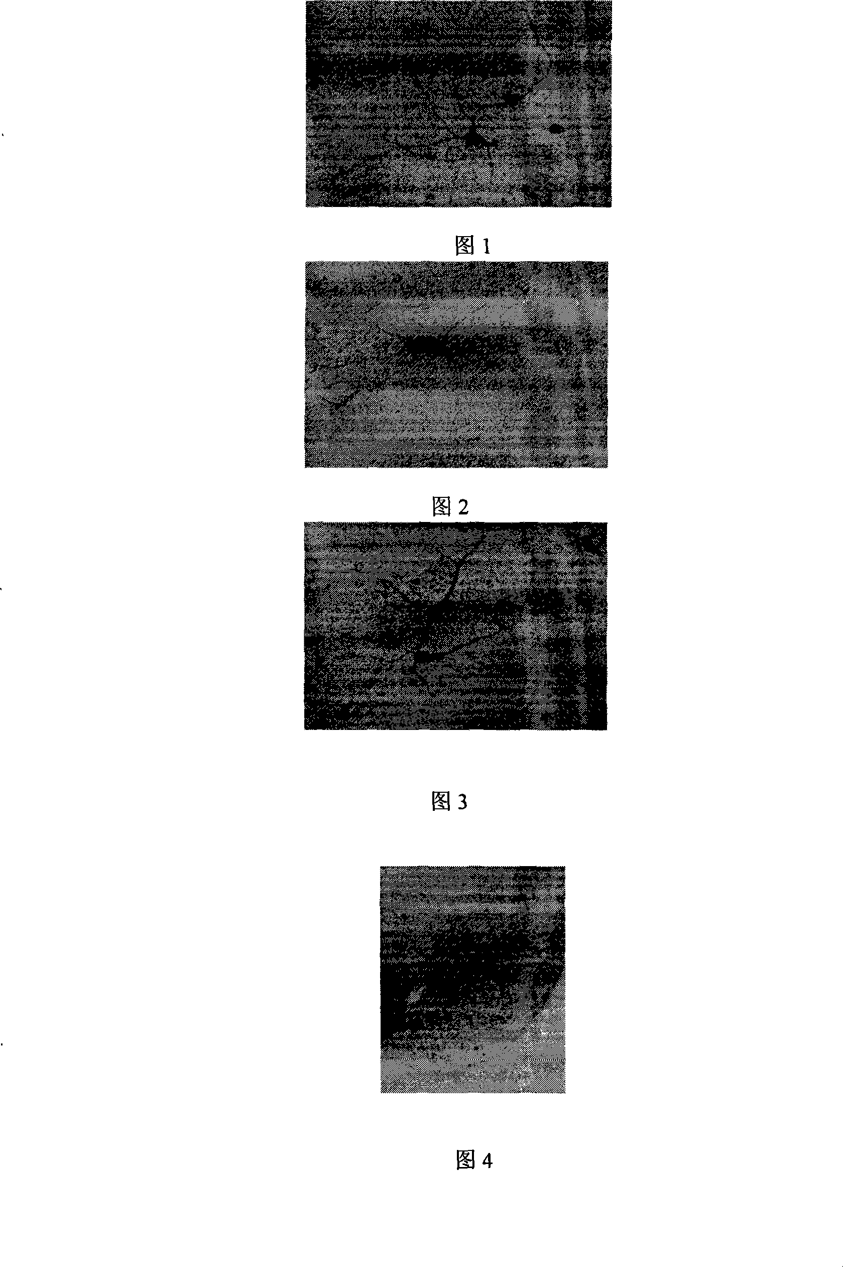 Novel method for preparing catalpol medicament composition containing the same and uses thereof