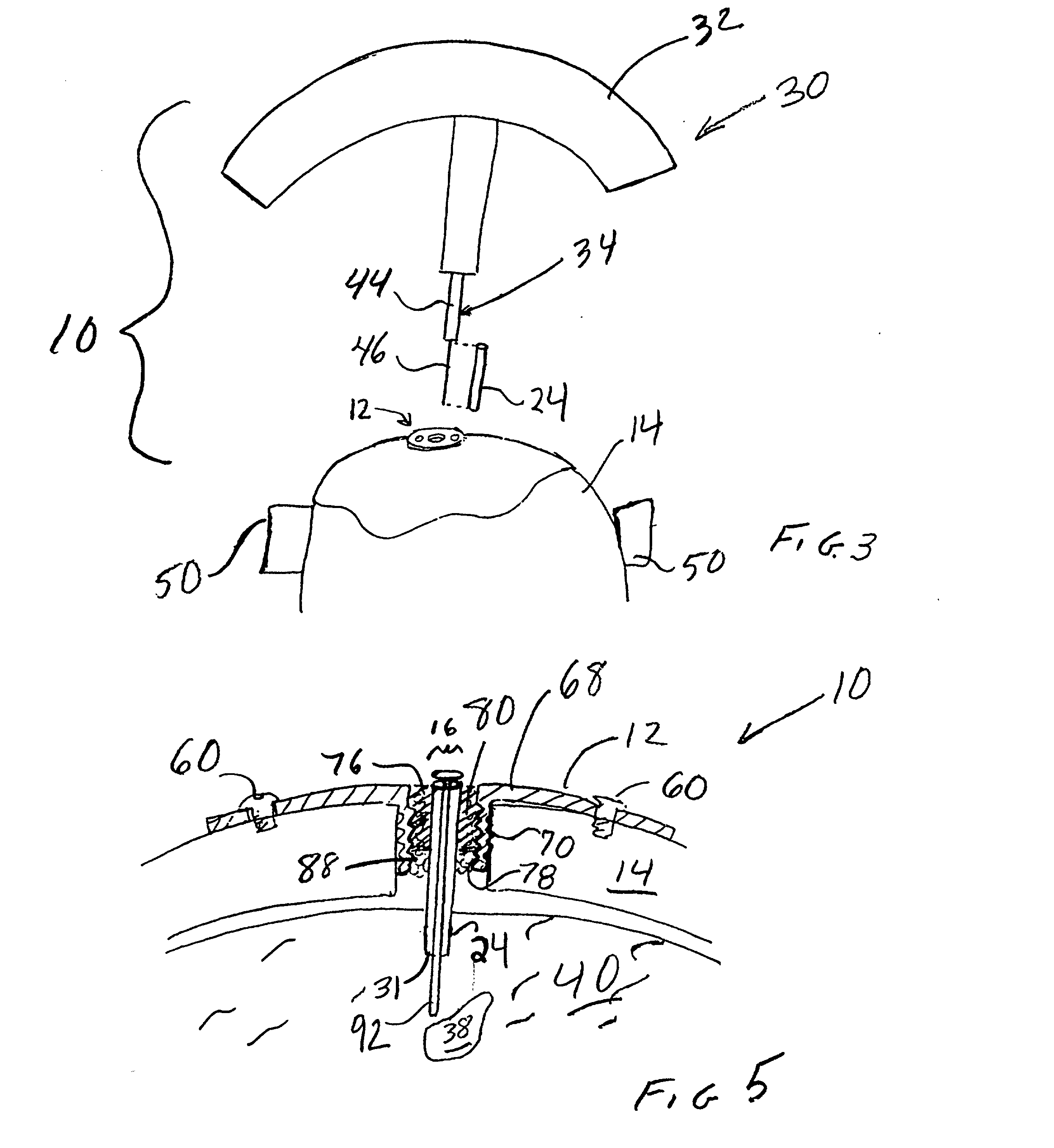 Stereotaxic detachable needle extension
