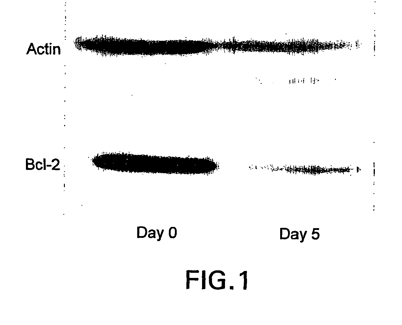 Methods of treatment of a bcl-2 disorder using bcl-2 antisense oligomers
