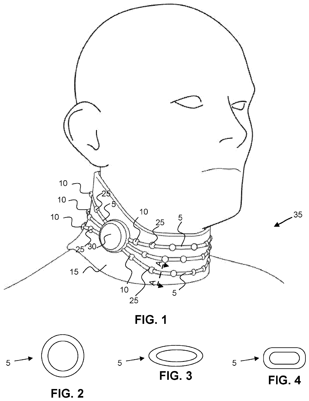 Intelligent Stop Shaking Device, System and Method